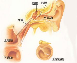 导致神经性睾丸附睾炎的原因