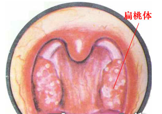 美国杰西等离子治疗系统解救您于阴茎短小