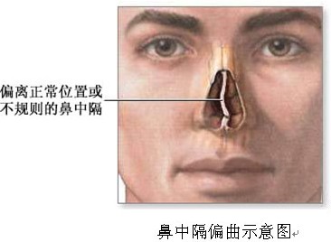 性欲障碍的症状有哪些？