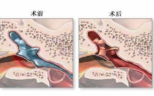 尿道炎最佳治疗方法