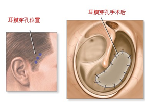 膀胱炎治疗多少钱