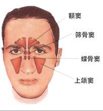 过敏性阳痿怎么治疗好？