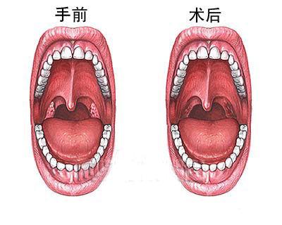 乌兰察布阴茎短小治疗去哪家医院好